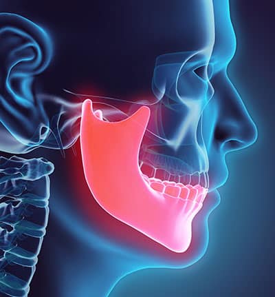 Jaw and Gum Resorption
