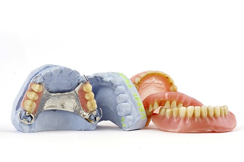 What Are Traditional Dentures