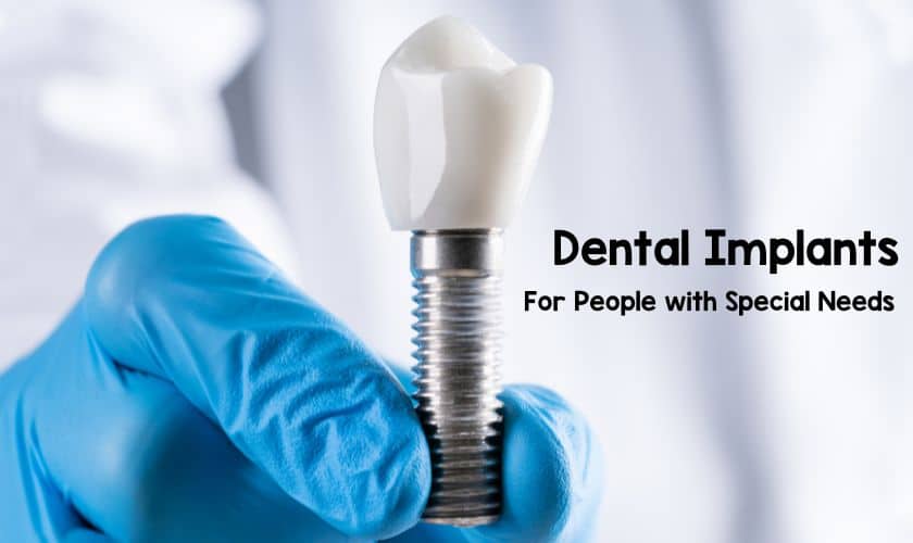 Dental implant, the solution for missing teeth and gum health.