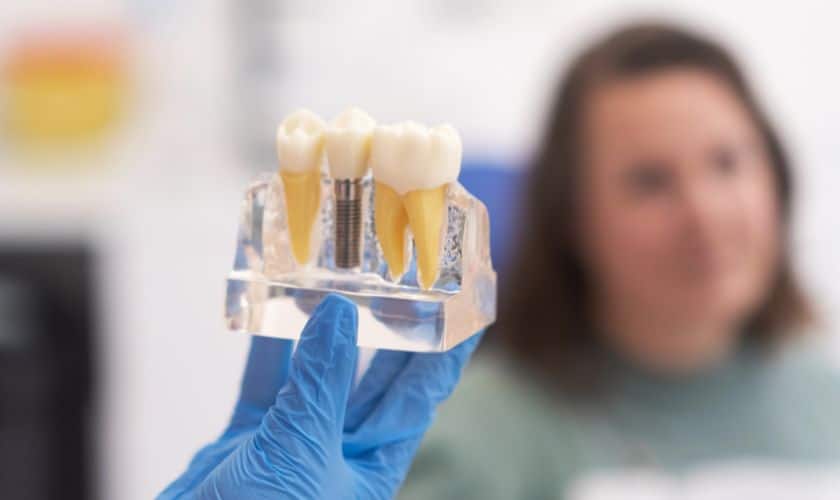 Implant Dentistry in Houston