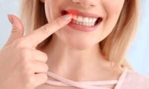 development of gum disease and its reasons
