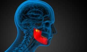 jaw bone structure and its role in dental implants